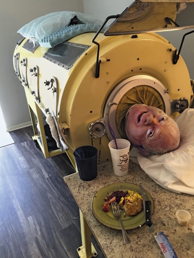 This is Paul Alexander, one of the last people living in an iron lung. In 1952, he contracted polio at the age of six and has has been living in the iron lung ever since. He is currently 78 years old.