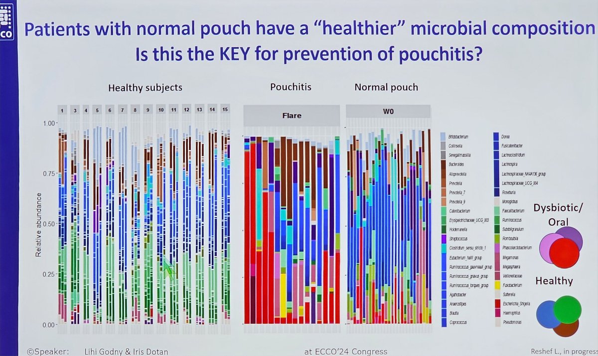 Robert Dudkowiak MD, PhD (@drrobindud) on Twitter photo Medical & dietetic management of the ileal pouch durig <a href="/D_ECCO_IBD/">D-ECCO</a>
workshops 🤩
Amazing lessons with amazing 🌟🌟from 🇮🇱 <a href="/Iris_Dotan/">iris dotan</a> & <a href="/LGodny/">Lihi Godny</a> 🫶🏻👌🏿🫶🏽
#diet 🥗
#microbiome🦠
#dysbiosis 🔃
#antibootics 💊
#inflamation 🔥
and #pouchitis 😬
#ECCO2024 🇸🇪 Medical & dietetic management of the ileal pouch durig <a href="/D_ECCO_IBD/">D-ECCO</a>
workshops 🤩
Amazing lessons with amazing 🌟🌟from 🇮🇱 <a href="/Iris_Dotan/">iris dotan</a> & <a href="/LGodny/">Lihi Godny</a> 🫶🏻👌🏿🫶🏽
#diet 🥗
#microbiome🦠
#dysbiosis 🔃
#antibootics 💊
#inflamation 🔥
and #pouchitis 😬
#ECCO2024 🇸🇪