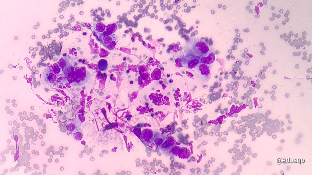 Eduardo Alcaraz, MD PhD tweet media