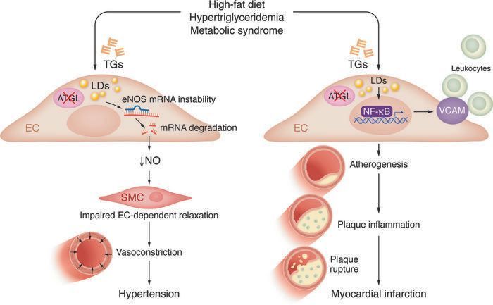 Journal of Clinical Investigation (@jclinicalinvest) on Twitter photo Commentary:
Lipid droplets in the endothelium: The missing link between metabolic syndrome and cardiovascular disease? buff.ly/3UPznkm
<a href="/IrisJaffeLab/">MCRI Jaffe Lab</a> <a href="/TuftsMedicalCtr/">Tufts Medical Center</a> <a href="/CedarsSinai/">Cedars-Sinai</a>
Related article: buff.ly/49HMXe0 Commentary:
Lipid droplets in the endothelium: The missing link between metabolic syndrome and cardiovascular disease? buff.ly/3UPznkm
<a href="/IrisJaffeLab/">MCRI Jaffe Lab</a> <a href="/TuftsMedicalCtr/">Tufts Medical Center</a> <a href="/CedarsSinai/">Cedars-Sinai</a>
Related article: buff.ly/49HMXe0
