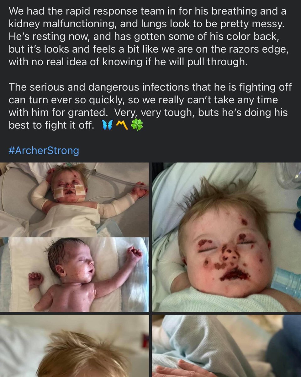 KB1824's tweet image. ‘Patience is waiting. Not passively waiting. That is laziness. But to keep going when the going is hard and slow - that is patience. The two most powerful warriors are patience and time.’ ~ Leo Tolstoy 

We’ve come a long way ~ Archer said this was “The best day of his life” 😀