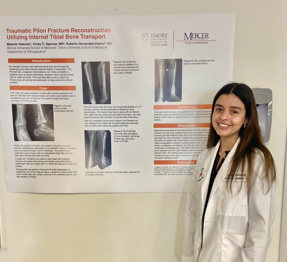 Presented my first fracture case study at the student research conference today 🦴