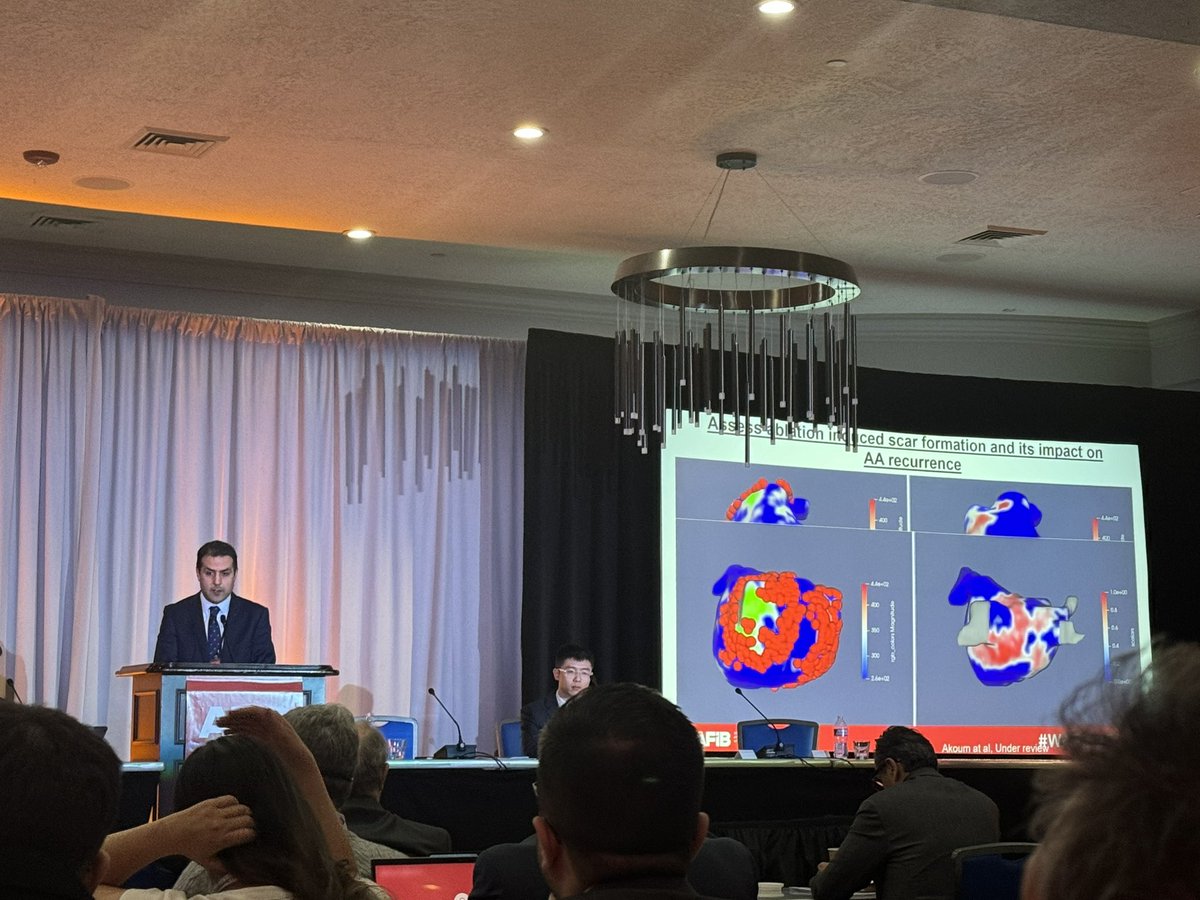 Ahmad Kassar (@ahmadkassar7) on Twitter photo Insights from #DECAAFII ‼️
- Lesions Delivered ≠ Scar Formed
- Low Fibrosis Patients -> More Scar Formed
- Better Ablation Results in Fibrosis Targeted Ablation
Greatly delivered by none other than Dr. <a href="/NazemAkoum/">Nazem Akoum</a>.
#WAFib2024
<a href="/UWMedHeart/">UWashington Heart Institute</a> <a href="/UWCardiology/">UW Cardiology</a> <a href="/UWDeptMedicine/">UW Department of Medicine</a> <a href="/UWBioE/">UW Bioengineering</a> Insights from #DECAAFII ‼️
- Lesions Delivered ≠ Scar Formed
- Low Fibrosis Patients -> More Scar Formed
- Better Ablation Results in Fibrosis Targeted Ablation
Greatly delivered by none other than Dr. <a href="/NazemAkoum/">Nazem Akoum</a>.
#WAFib2024
<a href="/UWMedHeart/">UWashington Heart Institute</a> <a href="/UWCardiology/">UW Cardiology</a> <a href="/UWDeptMedicine/">UW Department of Medicine</a> <a href="/UWBioE/">UW Bioengineering</a>