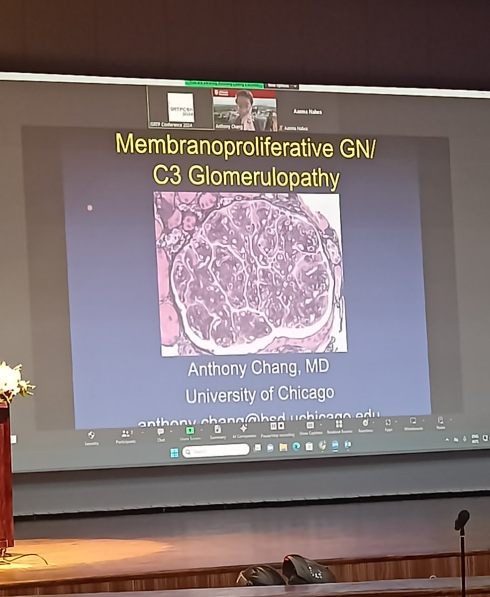 IndianRenal's tweet photo. @ChangUCanSpare speaking on Membranoproliferative GN/C3 GN at ISRTPCON2024 at Jodhpur. Pearls of wisdom from a stalwart in this field!
#renalpathology #MPGN #C3glomerulopathology #AIIMSjodhpur #ISRTP https://t.co/6tDusdrY4z