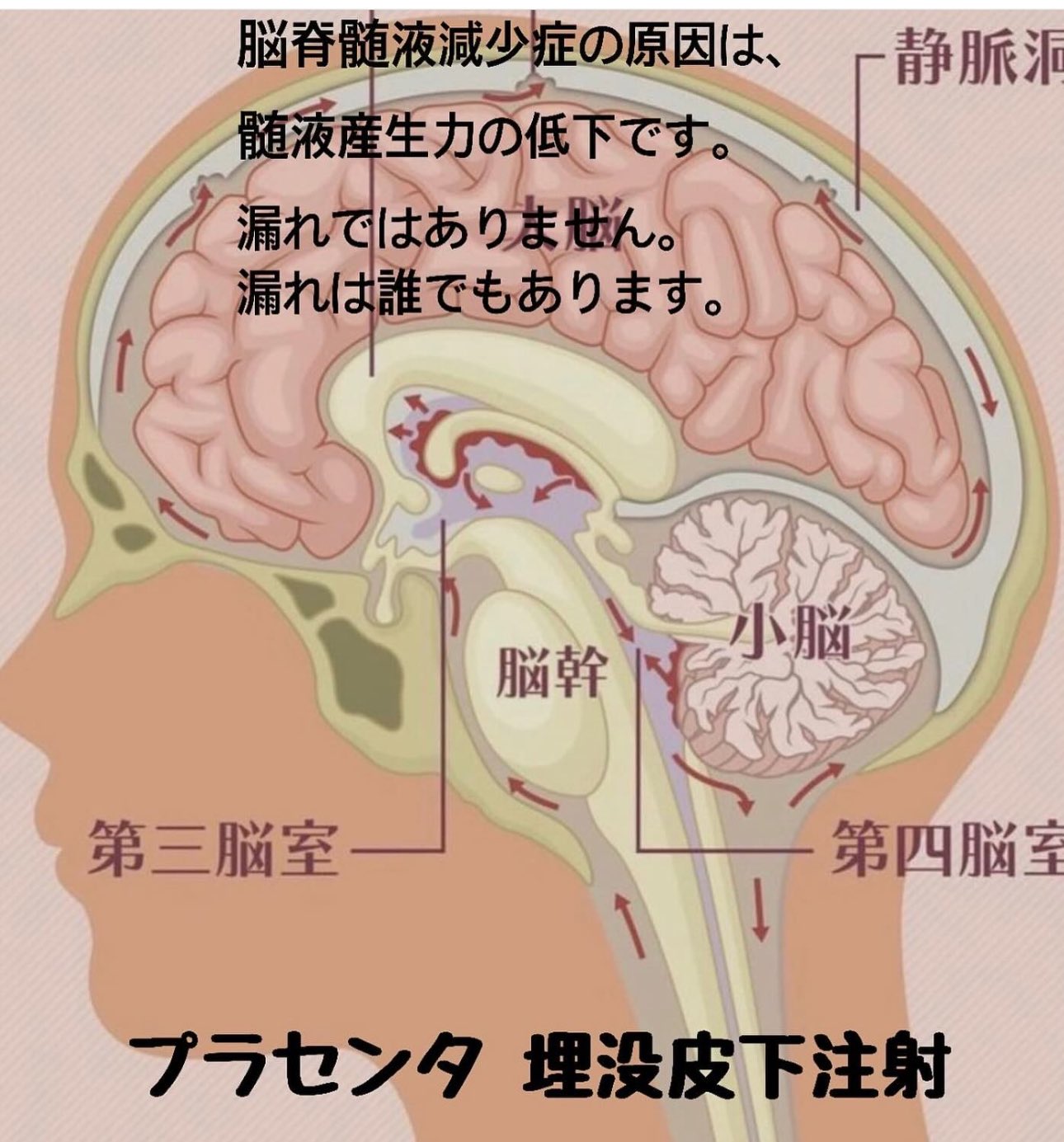 医療法人ひわき医院理事長樋脇一久 on X: 