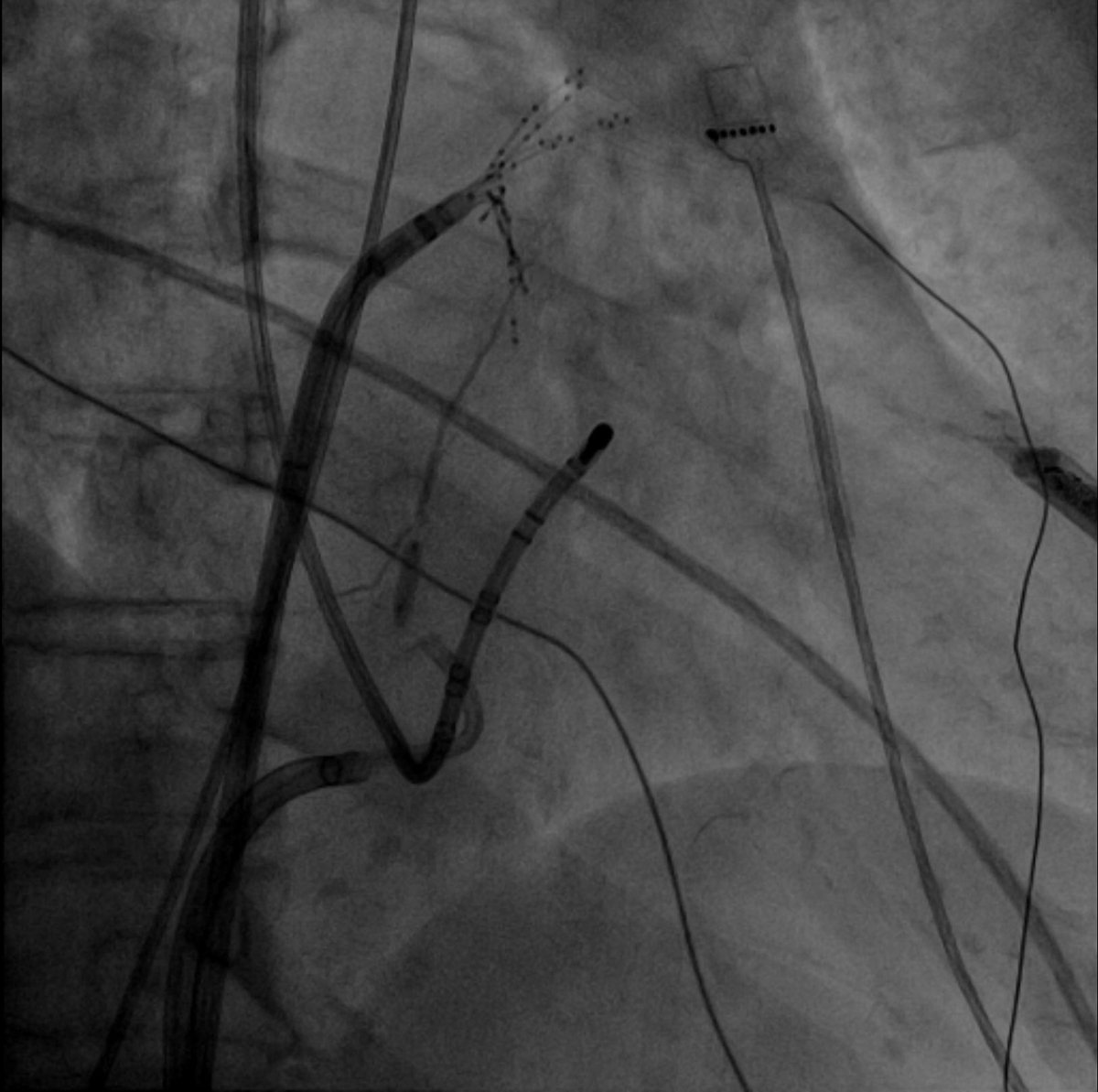 Francesco Peruzza tweet media