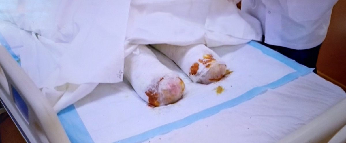 This is what Putin brought to Ukraine. So excuse me for wanting to Kill the bastard