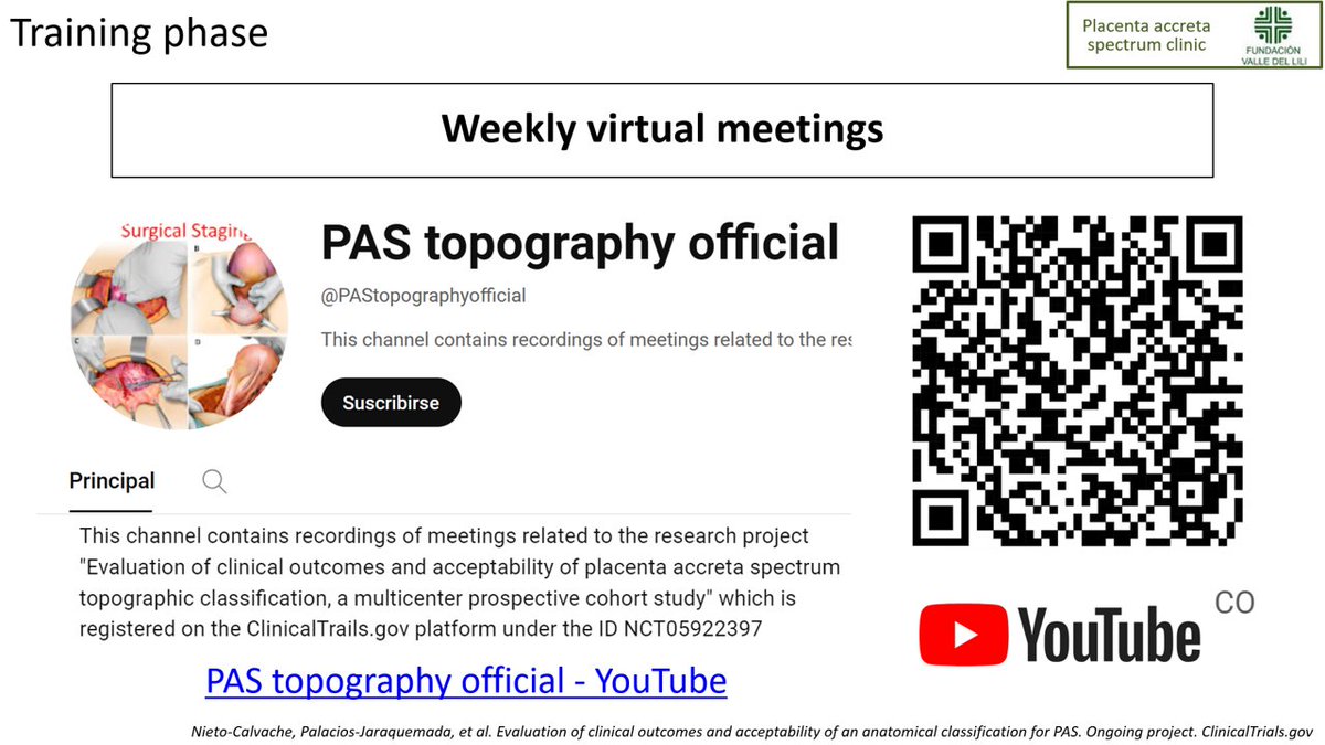 Albaro Nieto Calvache (@nieto_albaro) on Twitter photo clinicaltrials.gov/study/NCT05922…
Help us to build high quality evidence around PAS (accreta)
<a href="/dr_hibamustafa/">Hiba Mustafa, MD, FACOG, FAIUM, MFM, FOMA</a> <a href="/AmirShamshirsaz/">Amir Shamshirsaz</a> <a href="/AccretaResearch/">Sally Collins</a> <a href="/preventaccreta/">National Accreta Foundation</a> <a href="/placentaaccret3/">Placenta Accreta Ireland</a> <a href="/placentaaccret3/">Placenta Accreta Ireland</a> <a href="/azwildcat21/">Vini Shrivastava</a> <a href="/j_gil/">DrDr Jen Gilner 👩🏻⚕️🔬👭👭</a> @gattago <a href="/yafshar/">Yalda Afshar</a> <a href="/JayMunozMD/">Jessian L. Munoz, MD PhD MPH</a> <a href="/SmHooman/">Hooman Soleymani majd</a> <a href="/kristenterlizzi/">Kristen Terlizzi</a> <a href="/RoziAryananda/">roziadityaaryananda</a> clinicaltrials.gov/study/NCT05922…
Help us to build high quality evidence around PAS (accreta)
<a href="/dr_hibamustafa/">Hiba Mustafa, MD, FACOG, FAIUM, MFM, FOMA</a> <a href="/AmirShamshirsaz/">Amir Shamshirsaz</a> <a href="/AccretaResearch/">Sally Collins</a> <a href="/preventaccreta/">National Accreta Foundation</a> <a href="/placentaaccret3/">Placenta Accreta Ireland</a> <a href="/placentaaccret3/">Placenta Accreta Ireland</a> <a href="/azwildcat21/">Vini Shrivastava</a> <a href="/j_gil/">DrDr Jen Gilner 👩🏻⚕️🔬👭👭</a> @gattago <a href="/yafshar/">Yalda Afshar</a> <a href="/JayMunozMD/">Jessian L. Munoz, MD PhD MPH</a> <a href="/SmHooman/">Hooman Soleymani majd</a> <a href="/kristenterlizzi/">Kristen Terlizzi</a> <a href="/RoziAryananda/">roziadityaaryananda</a>