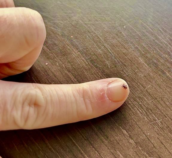 Brennan Lab CVR 🦠🕷🦟🔬🧫 (@brennanlab) on Twitter photo 🚨Never too early for a #tickcheck if you or your pets our out in nature 🚨
It seems they are active already this year #tick #awareness 🕷️ 🧍♀️ 🐶 this little critter was found today (25/02/24)!!
📸 .<a href="/stephmrainey/">Dr Steph Rainey</a> 🚨Never too early for a #tickcheck if you or your pets our out in nature 🚨
It seems they are active already this year #tick #awareness 🕷️ 🧍♀️ 🐶 this little critter was found today (25/02/24)!!
📸 .<a href="/stephmrainey/">Dr Steph Rainey</a>