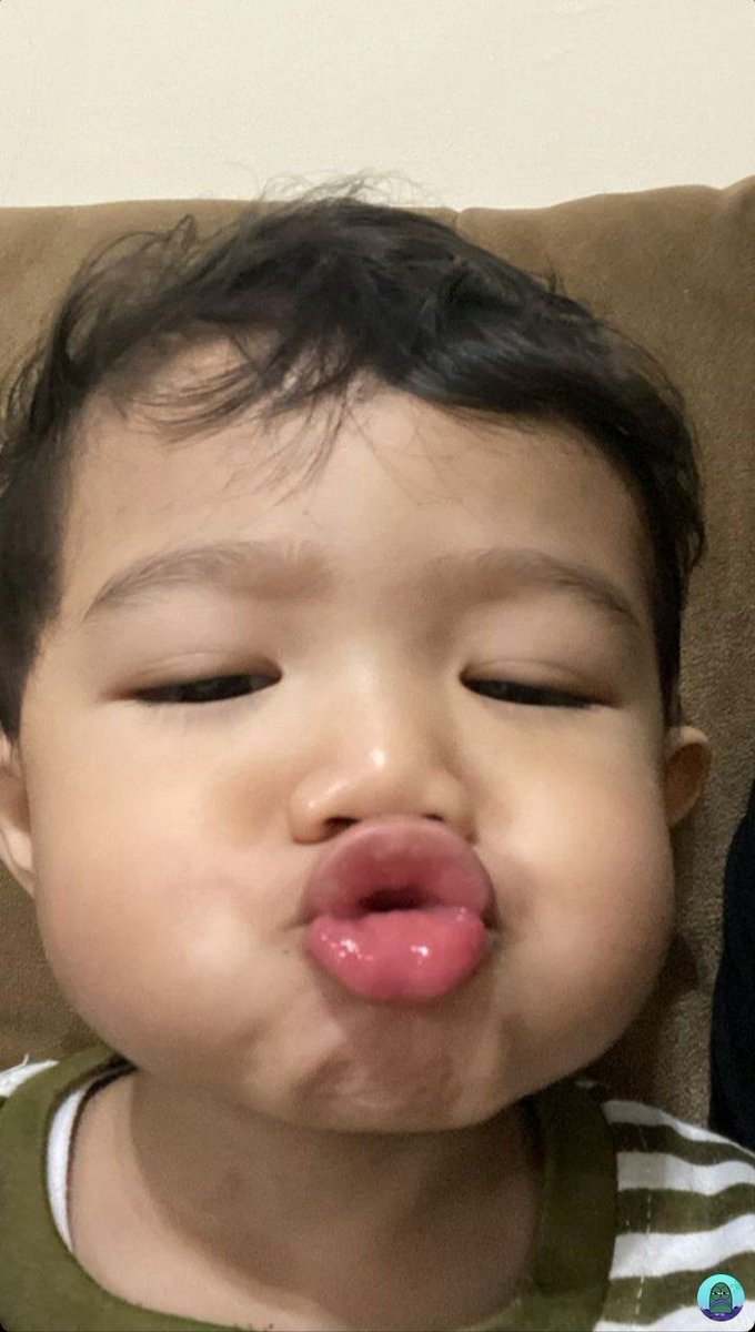 💚 WOY KENAPA ABE SELUCU DAN SEGEMAY INI KEK CIMOL PGN DI UYEL UYEL