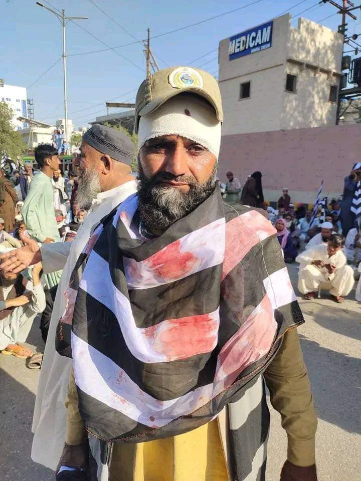 پاکستان کے تمام سیاسی و مذہبی جماعتوں میں پر امن اور اصولوں پر کار بند جےیوآئی کا منظم تنظیم انصار الاسلام کے رضاکاروں کا یہ حال کرنے والے حقیقت میں فسطائیت فاشزم کو فروغ دینے والے ہیں 
زرداری کو یہ سودا مہنگا پڑے گا 
#سندھ_بچانےنکلو