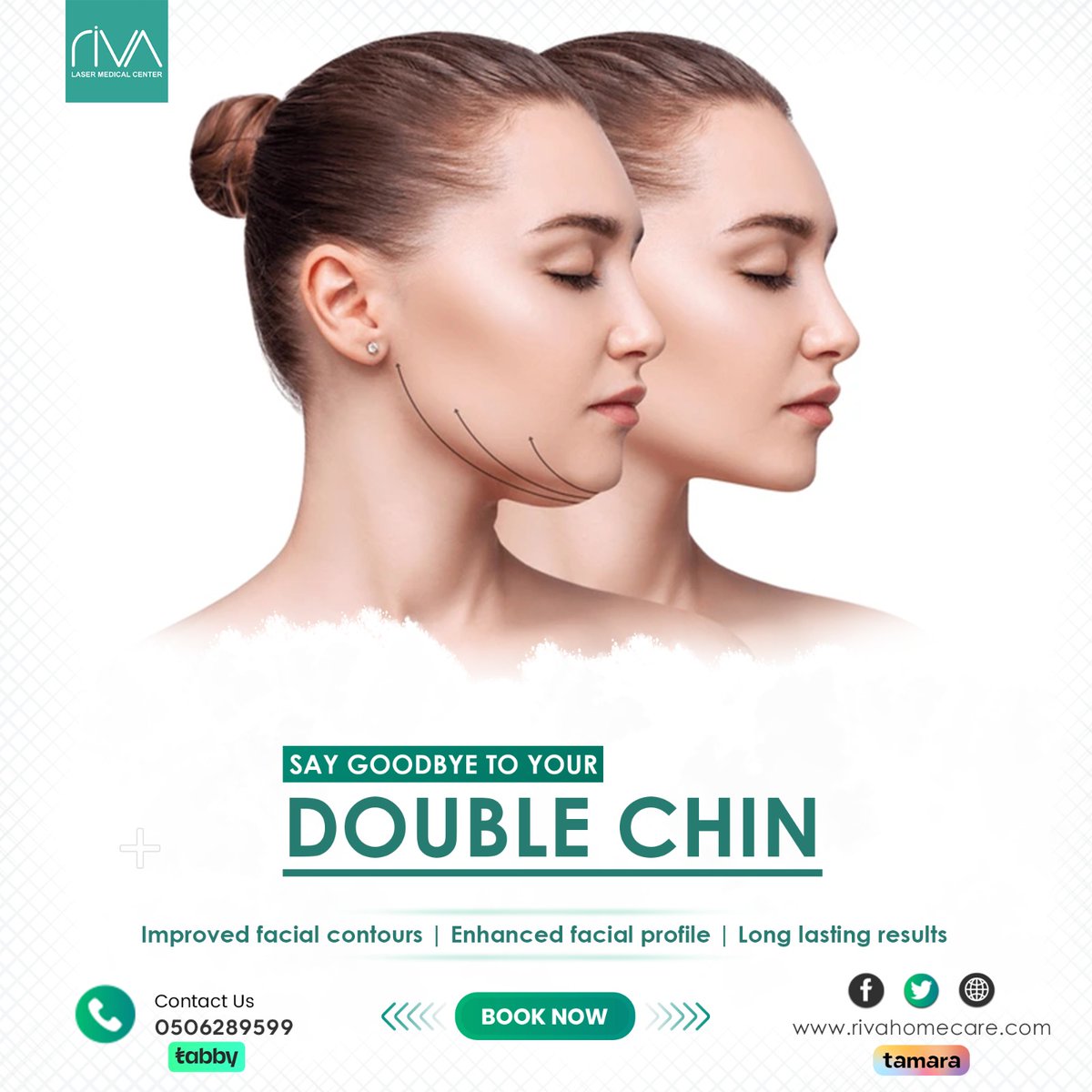 ✨ Say Goodbye to Double Chin with Our Advanced Treatment! ✨

Struggling with stubborn double chin? We've got the solution for you! 💫

Experience the transformative power of our Double Chin Treatment at Riva Laser Medical Center.
#DoubleChinTreatment #DefinedJawline #Confident