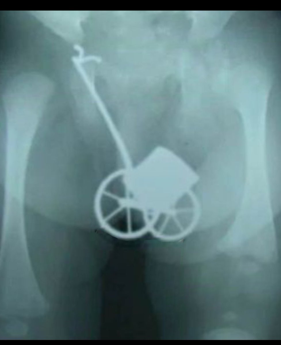 therepGP's tweet image. That time of year again 😂😂