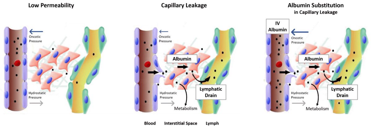 antoniobustme's tweet image. 📌 Ten myths about albumin 

Intravenous administration of crystalloid or colloid solutions is the most common intervention for correcting hypovolemia in #intensive care unit patients. 

doi.org/10.1007/s00134…