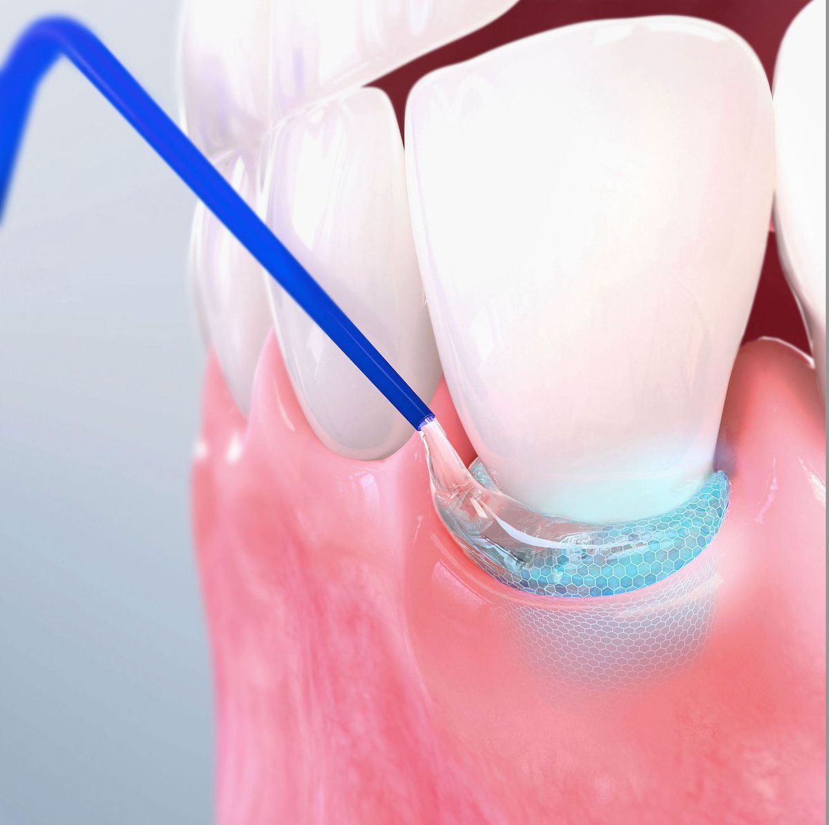 Medillustrates's tweet image. We are proud to introduce Quaint, a fantastic new medical illustration and animation studio!

Explore Quaint's portfolio: buff.ly/48n5KKl 

#quaint #visualstorytelling #medicalillustration #medicalvisualization #medicalanimation #rendering #3Danimation #community #sciart