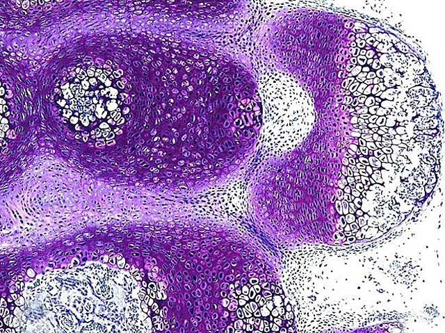 Development of rib deformation resulting from genetic mutation of mouse pudgy/DLL3 #gene – model for human #congenitaldisorders eg #spondylocostaldysostosis. Image & research by Frederic Shapiro, J Wang, E FLynn, @JoyYWu @StanfordMed in @BiologyOpen. On bpod.org.uk/archive/2024/2…