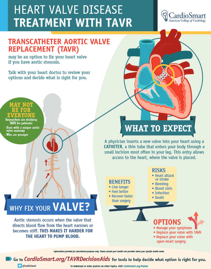 ACCinTouch's tweet image. Treatment with #TAVR helps patients live longer and have a shorter recovery time thanks to the less invasive procedure. 

Use #CardioSmart’s infographics to help patience understand the benefits and risks of TAVR and what to expect.
bit.ly/2ZuxjAz