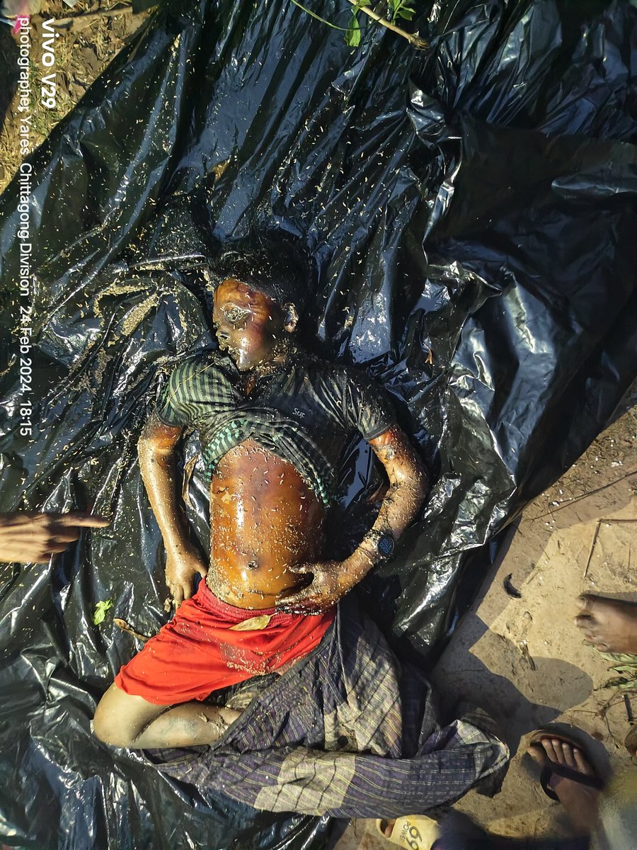 A 12-year-old  Rohingya boy  residing in Camp 1 East. He went missing on February 19.I regret that he was discovered deceased today near a forest of Foliyafara, Ukhiya. It is unjust that Rohingya faces such threats, being killed, murdered, and kidnapped in our lives everyday.