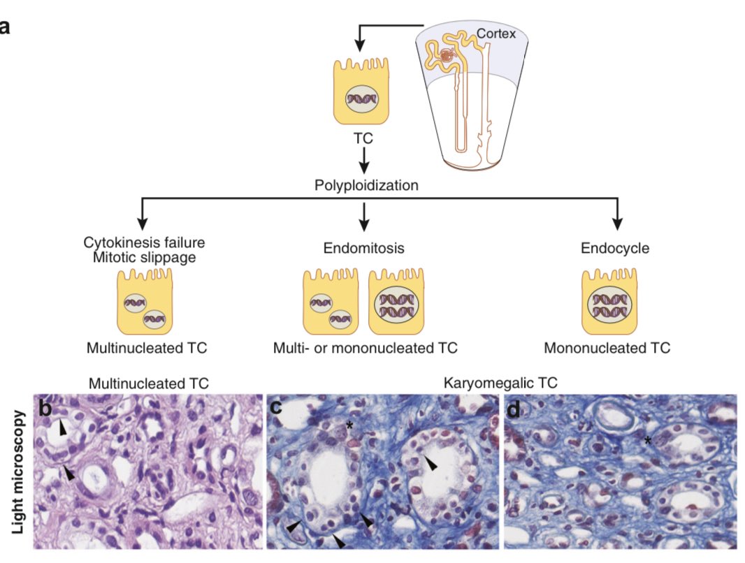 From plants to animals, polyploidy is the fastest way for adaptation to stress selected by evolution. The kidney tubule adapts to stress by polyploidy, too. We discuss evidences and consequences of this new concept in our new KI review doi.org/10.1016/j.kint…