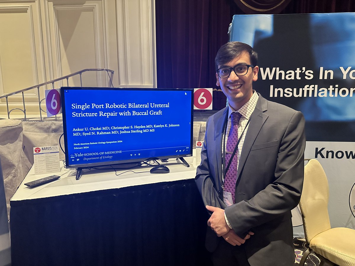 Soum Lokeshwar (@soumlokeshwar) on Twitter photo <a href="/ankurologie/">Ankur Choksi</a> at #NARUS2024 from <a href="/Yale_Urology/">Yale Urology</a> with a powerful presentation on SP Robotic Bilateral Ureteral Repair with Buccal Graft, future Endo/MIS Fellow! <a href="/jsterling15/">Joshua Sterling</a> <a href="/S_N_R290/">Syed Rahman</a> <a href="/RoboUro/">North American Robotic Urology Society | NARUS</a> <a href="/KateJohnsonMD/">Katelyn Johnson</a> <a href="/ankurologie/">Ankur Choksi</a> at #NARUS2024 from <a href="/Yale_Urology/">Yale Urology</a> with a powerful presentation on SP Robotic Bilateral Ureteral Repair with Buccal Graft, future Endo/MIS Fellow! <a href="/jsterling15/">Joshua Sterling</a> <a href="/S_N_R290/">Syed Rahman</a> <a href="/RoboUro/">North American Robotic Urology Society | NARUS</a> <a href="/KateJohnsonMD/">Katelyn Johnson</a>