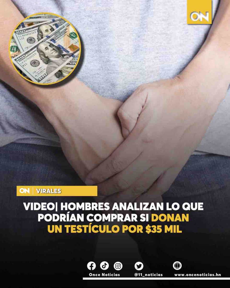 #VIRALES🟣| Muchos bromearon a través de los comentarios: “Muchachos, tengo una idea 💡”, “Al final pa’ que hijos”, “Me compro una moto y me sobra pa otra JAJAJAJA”, “¿Y yo como hago si soy mujer?”.

Mira el video AQUÍ👉: oncenoticias.hn/testiculo-35-m…

#Testículo #Donación #Viral