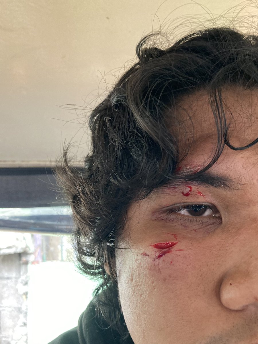 johnpeterangelo's tweet photo. Nagkagulo na rito sa harap ng munisipyo dahil sa mga di unipormadong naniktik na, nanuntok pa ng mga kabataan.

Pagkatapos mag-angas, ayun, tumabi at nag-report back sa mga pulis. https://t.co/w6s7Oq2wpv
