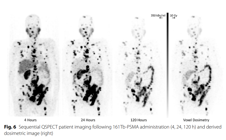Terbium-161 (161Tb) Quantitative SPECT/CT is here now!

link.springer.com/article/10.118…

<a href="/pj_physics/">Price Jackson</a> <a href="/ButeauJames/">James Buteau</a> 
<a href="/EANM_NucMed/">European Association of Nuclear Medicine (EANM)</a> 
violet-trial.com #VIOLET