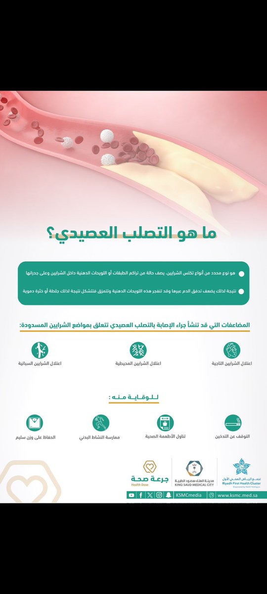 9saad99's tweet photo. ماهو التصلب العصيدي..؟ https://t.co/YysBnBIKwI