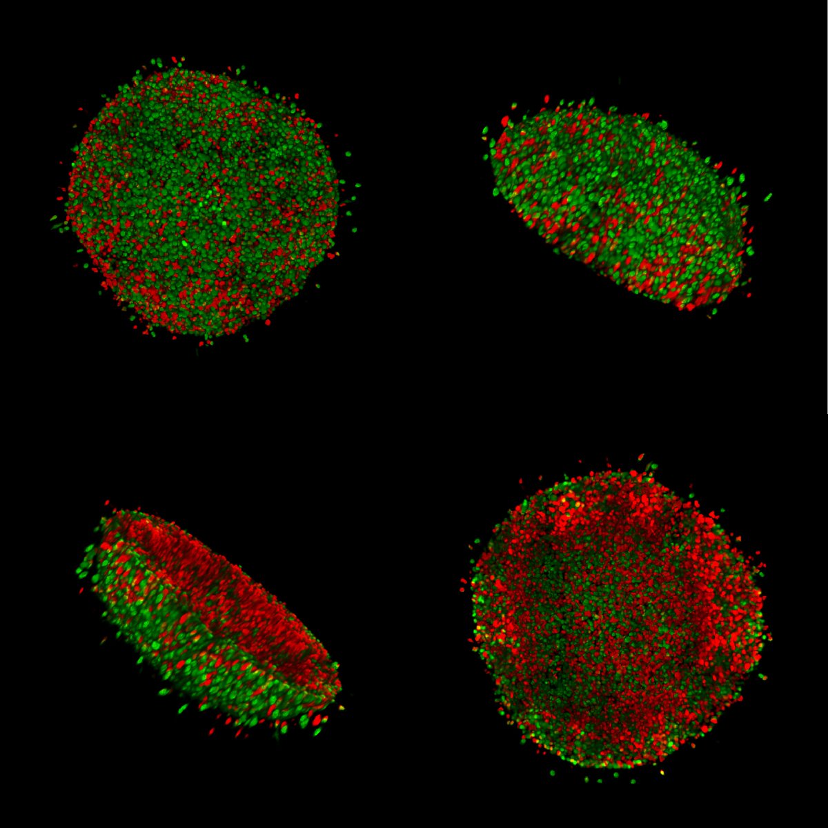Just out! 
Spoerri, Beaumont, Anfosso, <a href="/RyanMurphy42/">Ryan Murphy</a>, <a href="/a13xbrowning/">Alex Browning</a>, Gunasingh, Haass 
Real-time cell cycle imaging in a 3D cell culture model of melanoma, quantitative analysis, optical clearing, and mathematical modelling. Methods Mol Biol 2764: 291-310
link.springer.com/.../10.1007/97…