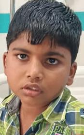 ivdsai's tweet image. బిడ్డను బతికించుకోవాలని ఓ నిరుపేద గిరిజన తల్లి ఆరాటం. తల్లి రోజు కూలి, తండ్రి కుటుంబాన్ని వదిలేసాడు. ఇద్దరు చిన్న పిల్లలు. పెద్ద బిడ్డ భూక్య నాగరాజుకు ( 9 సంవత్సరాలు ) కొన్ని సంవత్సరాలుగా fits రావడం , స్పృహ తప్పడం జరుగుతోంది. Brain లో ట్యూమర్ గడ్డ. తల్లికి గుండె కోత. బిడ్డల కడుపు…