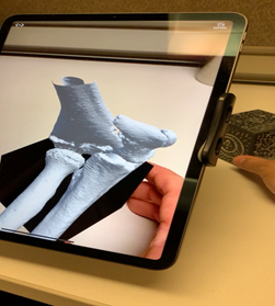 3dheals's tweet photo. Congrats to @SiraMedical on #FDAClearance for #AugmentedReality #Preoperative #SurgicalPlanning Software #ARVR #Pitch3D 
https://t.co/nCdV2s9IPI https://t.co/k78Ju7oJYr