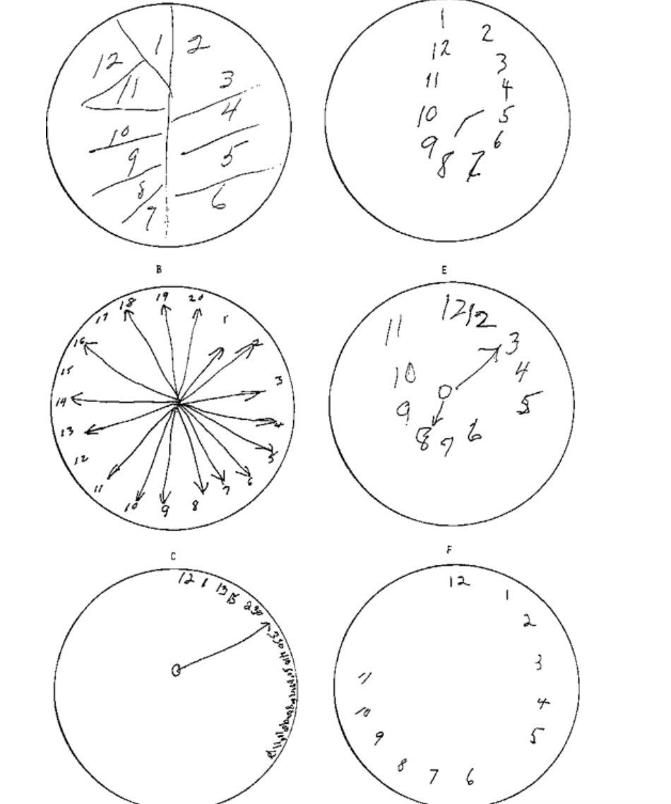 What diseases are each of these 6 clocks from ?