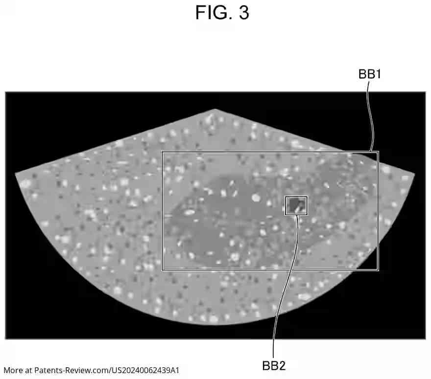 PatentPulse's tweet photo. 🆕 #Fujifilm's latest patent apl. #US20240062439A1 revolutionizes ultrasound imaging! Their tech intelligently highlights organs within images, making unclear boundaries a thing of the past. A game-changer for medical diagnostics! 🏥💡 #Innovation #HealthTech #PatentWatch https://t.co/Pm0vIWqrTo