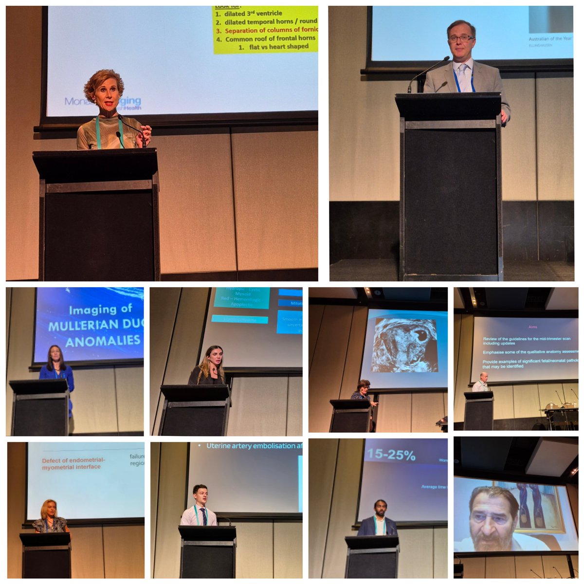 OGSIG ASM 2024.... Just WOW! Thank you to all our speakers, especially keynote speakers Prof Stacy Goergen and A/Prof Ricardo Palma-Dias. Amazing talks, opportunities to network and great venue made for a fabulous day of O&G Imaging. So much engagement and discussion.