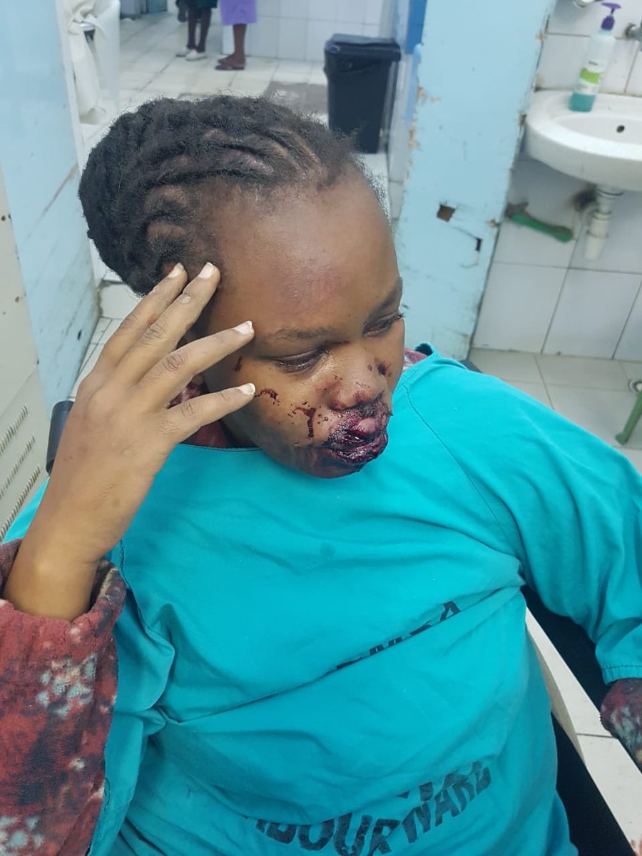 RobertAlai's tweet photo. There is a property being developed on public land which belongs to KMA in South C. 

When Nairobi County enforcement team went to inspect the development, they were attacked. 

Seems like the thuggery in the development in Nairobi is sanctioned by all authorities. https://t.co/h3pdkFEi9Q