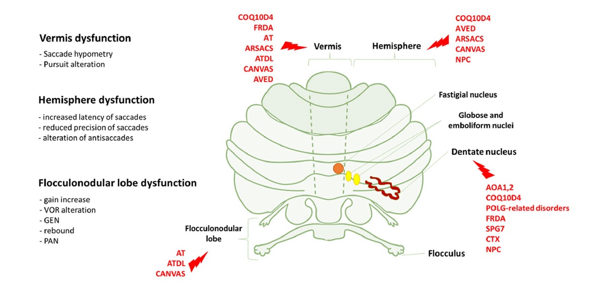 Autosomal recessive cerebellar #ataxias: a diagnostic classification approach according to #ocular features ncbi.nlm.nih.gov/pmc/articles/P…