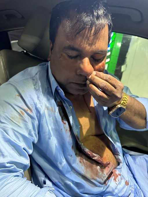 میاں نوازشریف کی کل اور خواجہ سعد رفیق، سردار ایاز صادق کی آج اچھی اچھی باتوں والی تقریروں کا جواب۔

سٹیج کے معروف اداکار اور کامیڈین طاہر انجم پر پی ٹی آئی کے بلوائیوں کا حملہ۔ میری ابھی طاہر سے تفصیلی بات ہوئی۔ وہ مریم نواز کے وزیر اعلیٰ بننے کی خوشی میں بابو صابو میں ایک ویڈیو