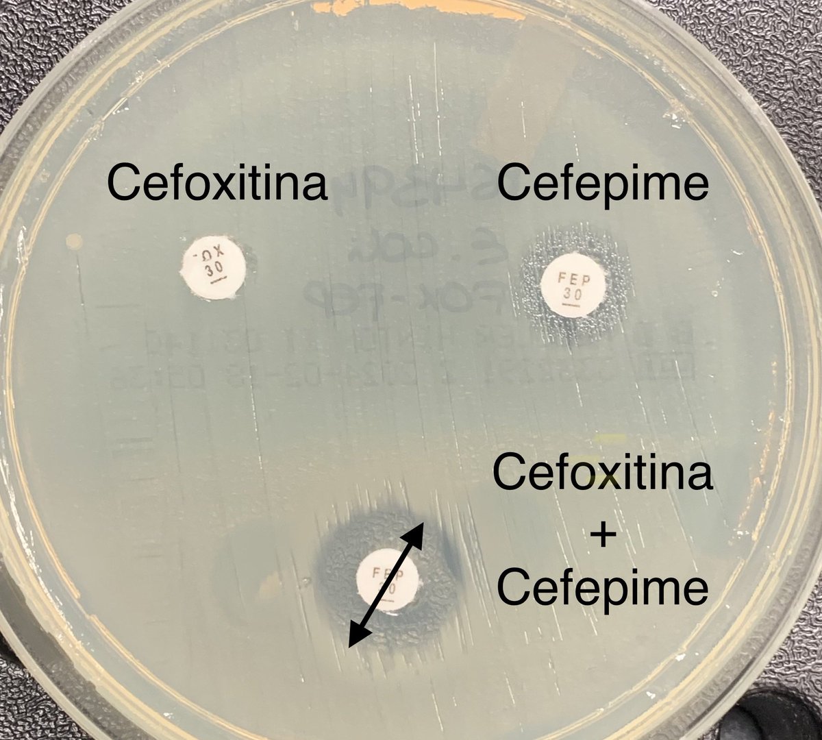 MICROBIOLOGÍA - Hospital Clínico de Valencia tweet media