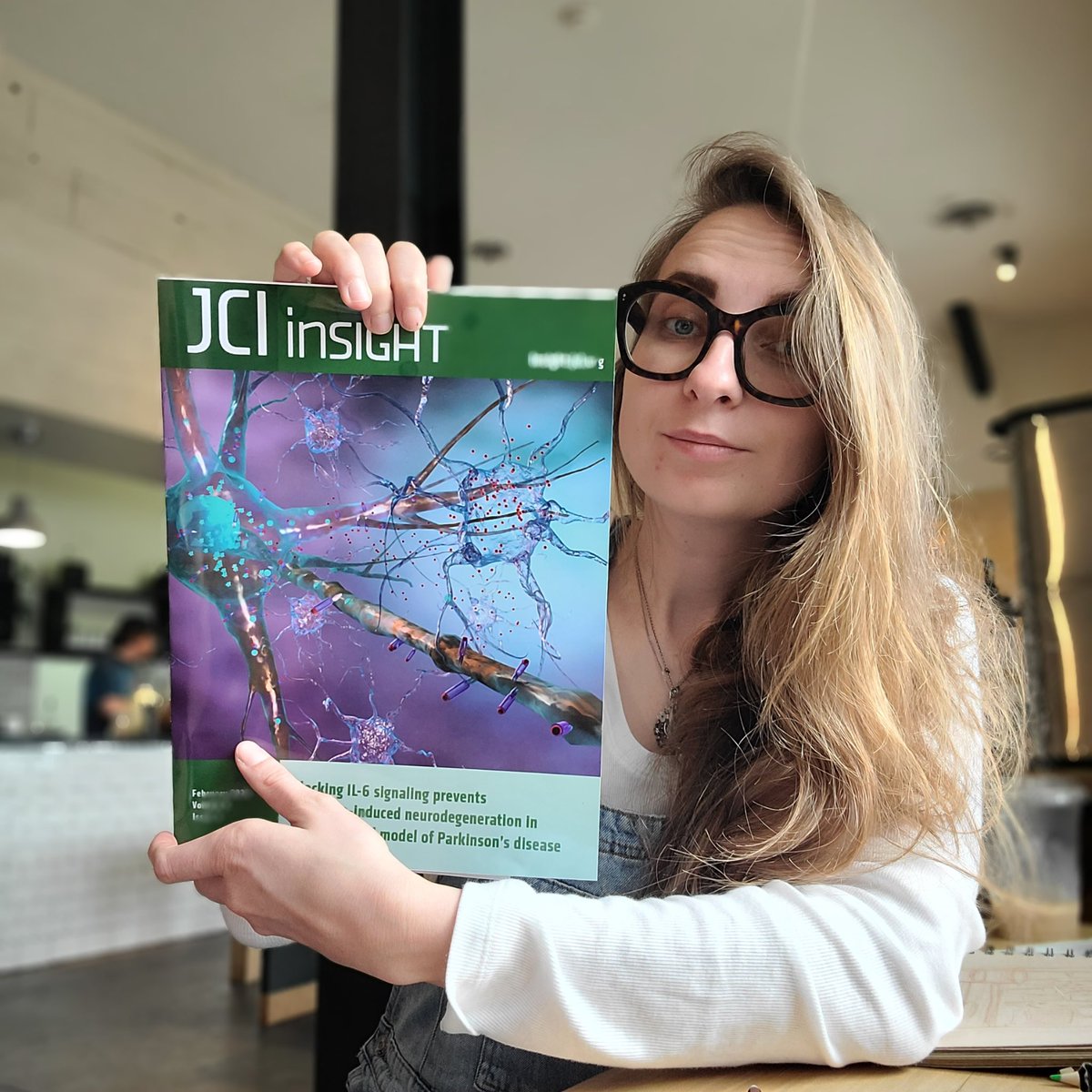 🧠 Parkinson & Inflammation💥 @JCI_insight Parkinson's disease (PD) involves the loss of dopamine neurons in the brain. Research shows that inflammation, particularly involving astrocytes, may contribute to this process. @txell_pons, @angiedidomenico, @BigSpinLab, @agrrp,…