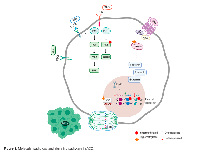Bassel Nazha, MD, MPH (@basselnazha) on Twitter photo Delighted to share our latest piece on adrenocortical carcinoma 🗞️✅
⭐️It was a true pleasure working with the amazing <a href="/DivyaReddyMD/">Divya Chukkalore</a> <a href="/MacdougallKira/">Kira MacDougall, M.D.</a> who are also SIUH comrades 🗽
<a href="/WinshipAtEmory/">Winship Cancer Institute of Emory University</a> <a href="/bilenma/">Mehmet Asim Bilen,MD</a> <a href="/virajmaster/">Viraj Master</a>
doi.org/10.1093/oncolo… Delighted to share our latest piece on adrenocortical carcinoma 🗞️✅
⭐️It was a true pleasure working with the amazing <a href="/DivyaReddyMD/">Divya Chukkalore</a> <a href="/MacdougallKira/">Kira MacDougall, M.D.</a> who are also SIUH comrades 🗽
<a href="/WinshipAtEmory/">Winship Cancer Institute of Emory University</a> <a href="/bilenma/">Mehmet Asim Bilen,MD</a> <a href="/virajmaster/">Viraj Master</a>
doi.org/10.1093/oncolo…