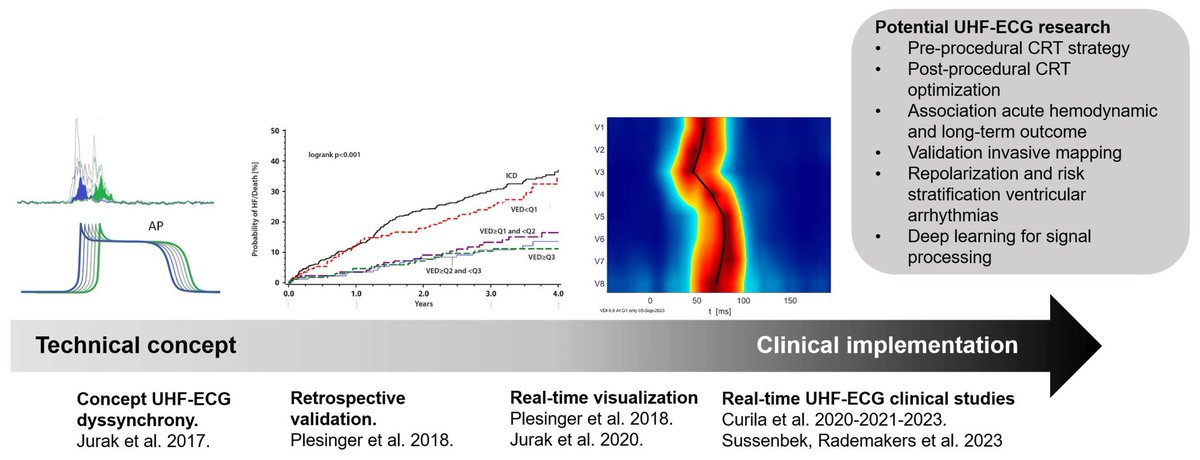Uyen Chau Nguyen (@uyenchaunguyen1) on Twitter photo Hope you check out our paper exploring the physiological background of higher frequencies in ventricular activation and the translational journal of the UHF-ECG technique <a href="/pavel_jurak/">Pavel Jurák</a> <a href="/curilakarol/">curilakarol</a> <a href="/kvernooy/">Kevin Vernooy</a>
<a href="/JLuermans/">Justin Luermans</a> <a href="/MirekNavratil1/">Mirek Navratil</a>  mdpi.com/2308-3425/11/3… Hope you check out our paper exploring the physiological background of higher frequencies in ventricular activation and the translational journal of the UHF-ECG technique <a href="/pavel_jurak/">Pavel Jurák</a> <a href="/curilakarol/">curilakarol</a> <a href="/kvernooy/">Kevin Vernooy</a>
<a href="/JLuermans/">Justin Luermans</a> <a href="/MirekNavratil1/">Mirek Navratil</a>  mdpi.com/2308-3425/11/3…