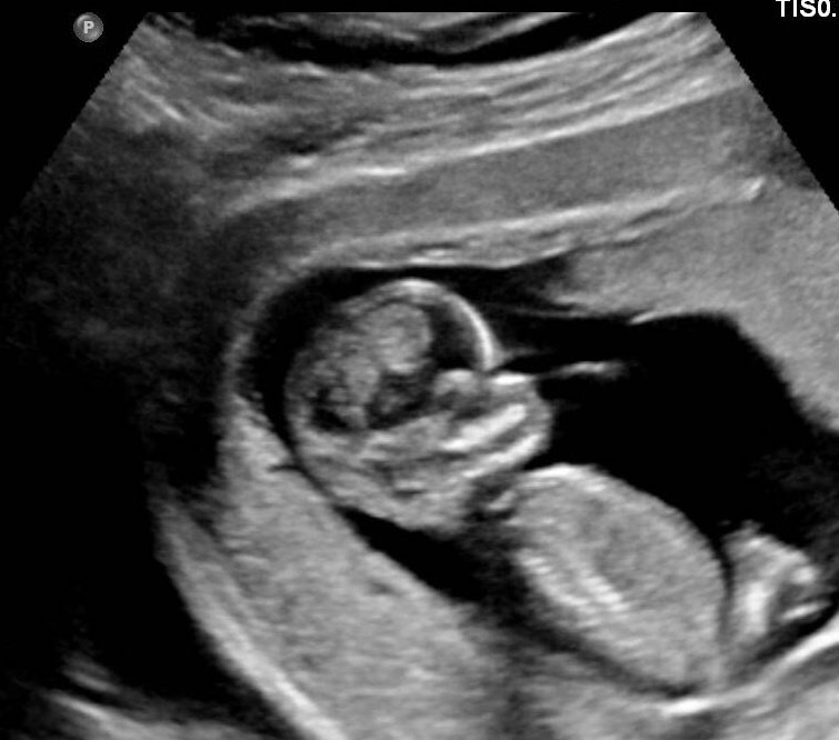 James | CripsyTV 🇦🇺 tweet media