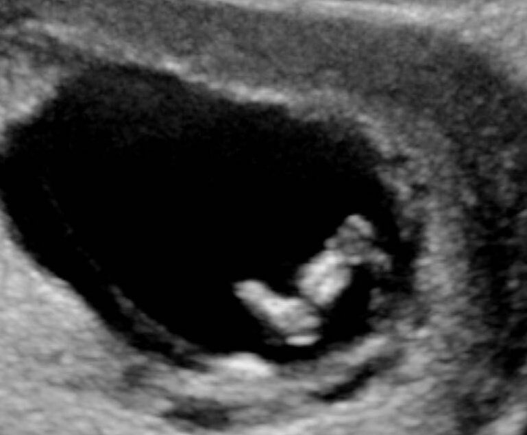 James | CripsyTV 🇦🇺 tweet media