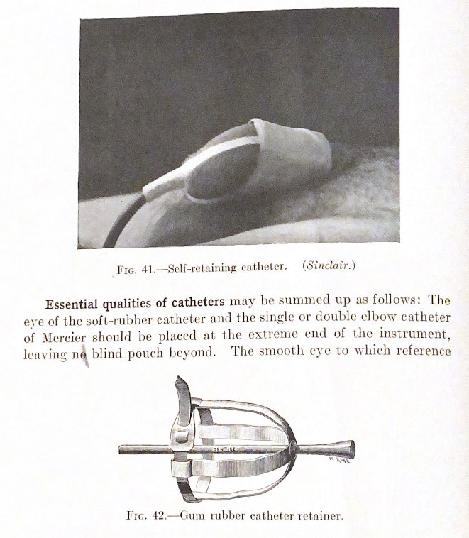 Les ancêtres des sondes de Foley à ballonet: 
Les sondes vésicales étaient maintenues en place avec des adhésifs ou des sortes de muselières en gomme de caoutchouc.
(The Practice of Urology, Chetwood, 1916)