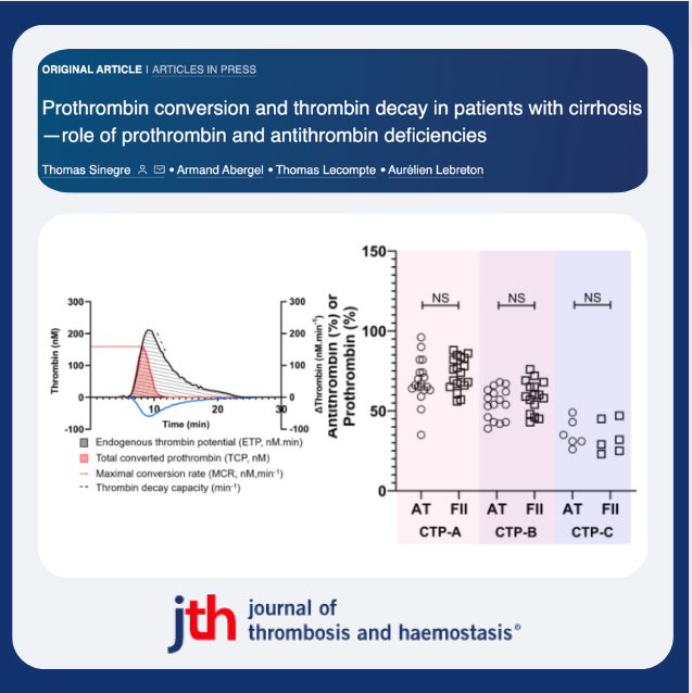 JTHjournal's tweet photo. Thrombin generation (TG) ➕thrombomodulin (TG-TM) in plasma of cirrhosis (PWC) pts ▶️ hypercoagulable phenotype.
Sinegre et al show this is due to impaired thrombin decay, low prothrombin levels do not ▶️📉prothrombin conversion.
https://t.co/BwggoiOe8z
@aurelebre @ELShematology https://t.co/By5wzrTZLh