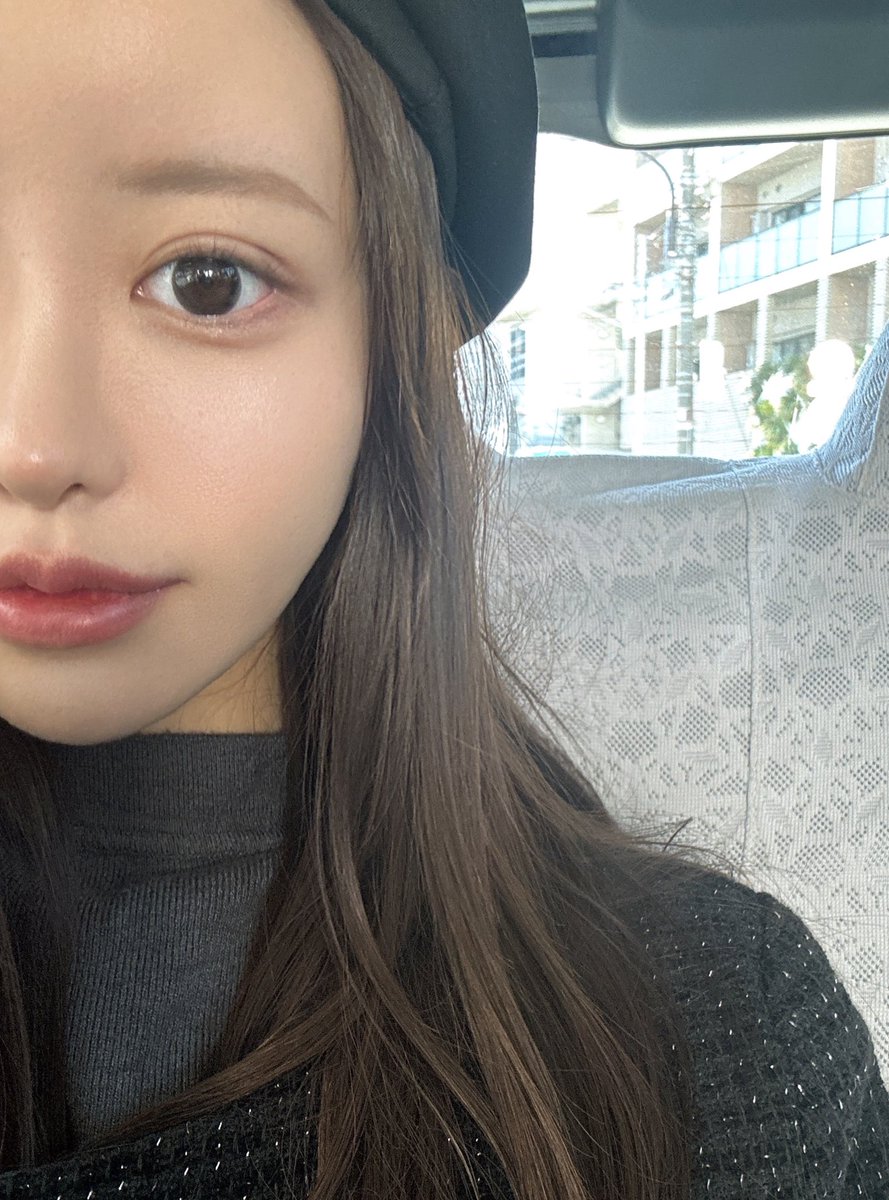 sugerrrr91's tweet photo. 埋没修正してきた✌🏻腫れのピーク1日目でこれ！DTとは？ってかんじ。神？🥺
🏥はドクター松井クリニック、prでもなく昔から信頼してる先生🙏🏻 https://t.co/aG2iXrym57
