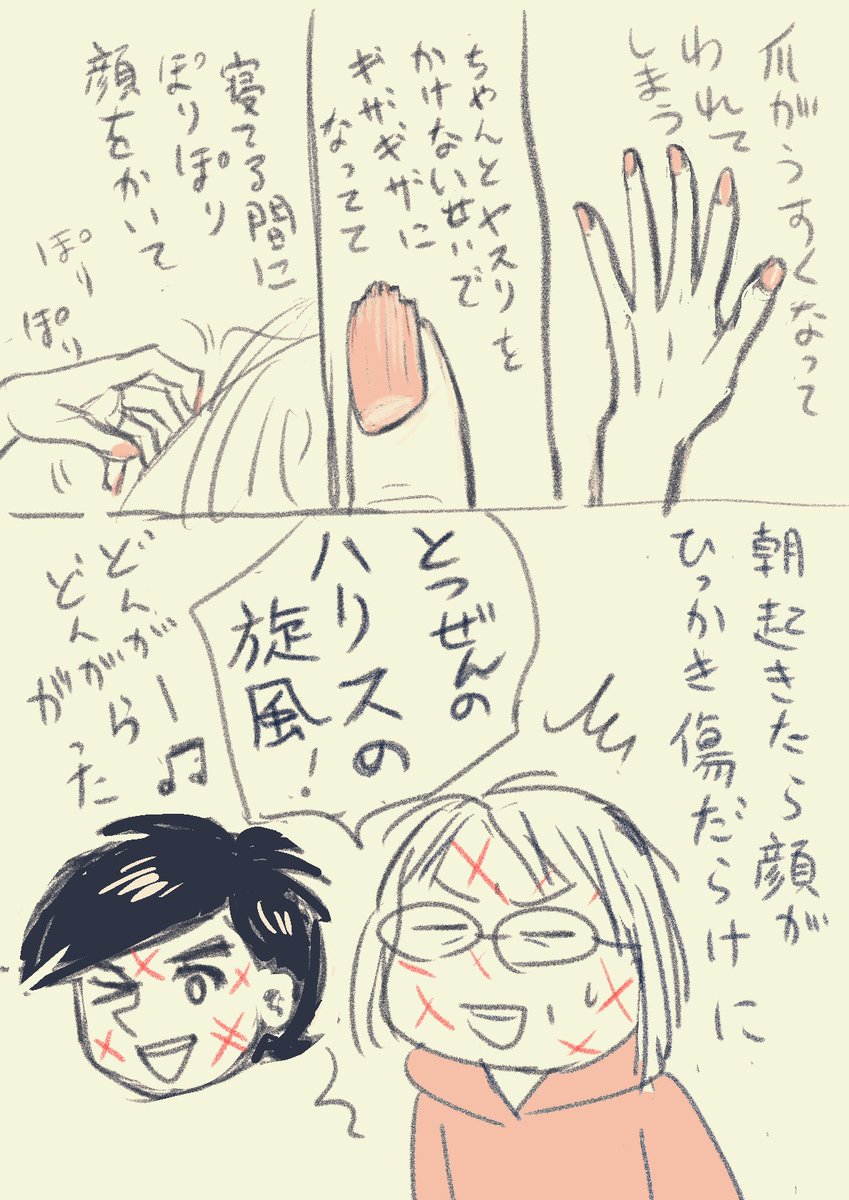 ほのぼの絵日記
こんなぺけぺけ傷、漫画でしか見たことねーわって鏡見て笑ってた。
あと今日、結婚記念日だったのころっと忘れてた。
226なら覚えやすいねって決めといて忘れたわ。
結婚したことはまだ覚えてるからギリ大丈夫。 