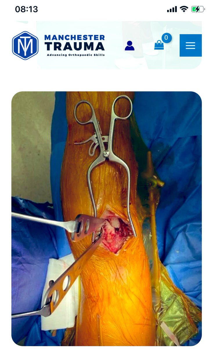 Exactly one week to our cadaver lower limb trauma course. We look forward to welcoming delegates and faculty. It is going to be great fun manchestertrauma.com/manchester-low… #trauma #injury #surgicaltraining @bota_uk @BritOrthopaedic