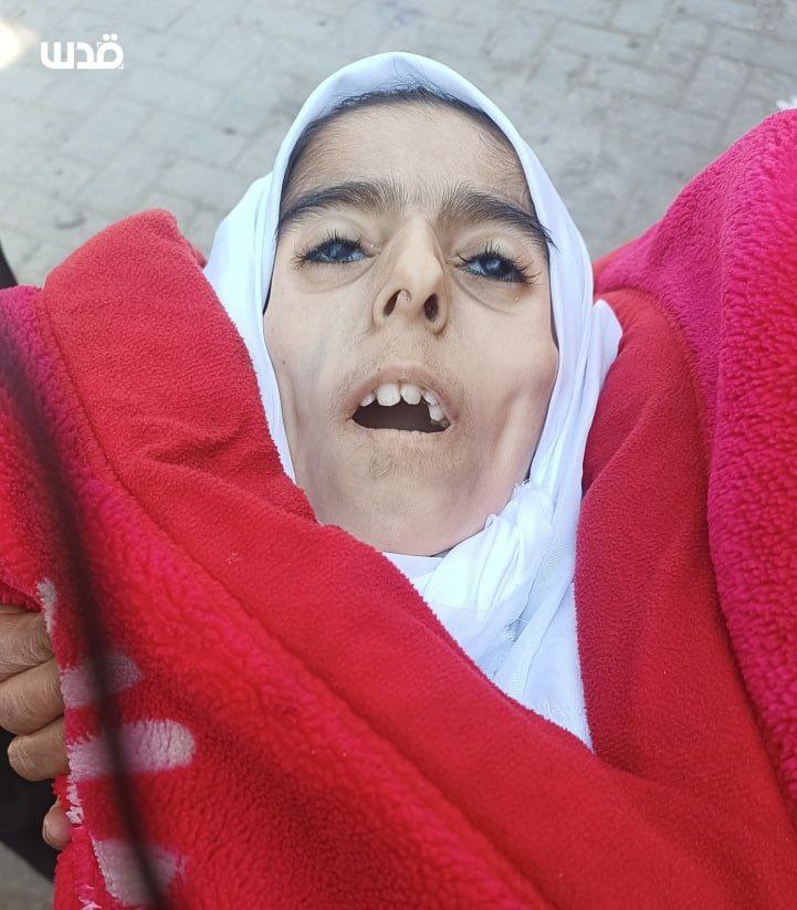 İlham Cuhâ isimli 17 yaşındaki Filistinli bir genç kız, #Gazze'de açlık sebebiyle şehit düştü.