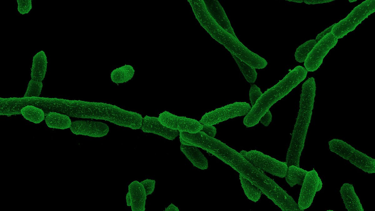 Die Bakterienvielfalt im Darm variiert, besonders bei #Segatellen. Sie sind Bestandteil des #Darmmikrobiom|s. Mediziner:innen haben ihr Vorkommen bei Männern untersucht &amp; sehen einen Zusammenhang zwischen #Sexualverhalten und der #Artenvielfalt im Darm🧐. uni-due.de/2024-02-22-sex…